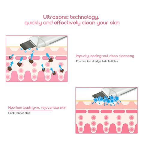 DermaSonic – Ultrasonic Skin Scrubber